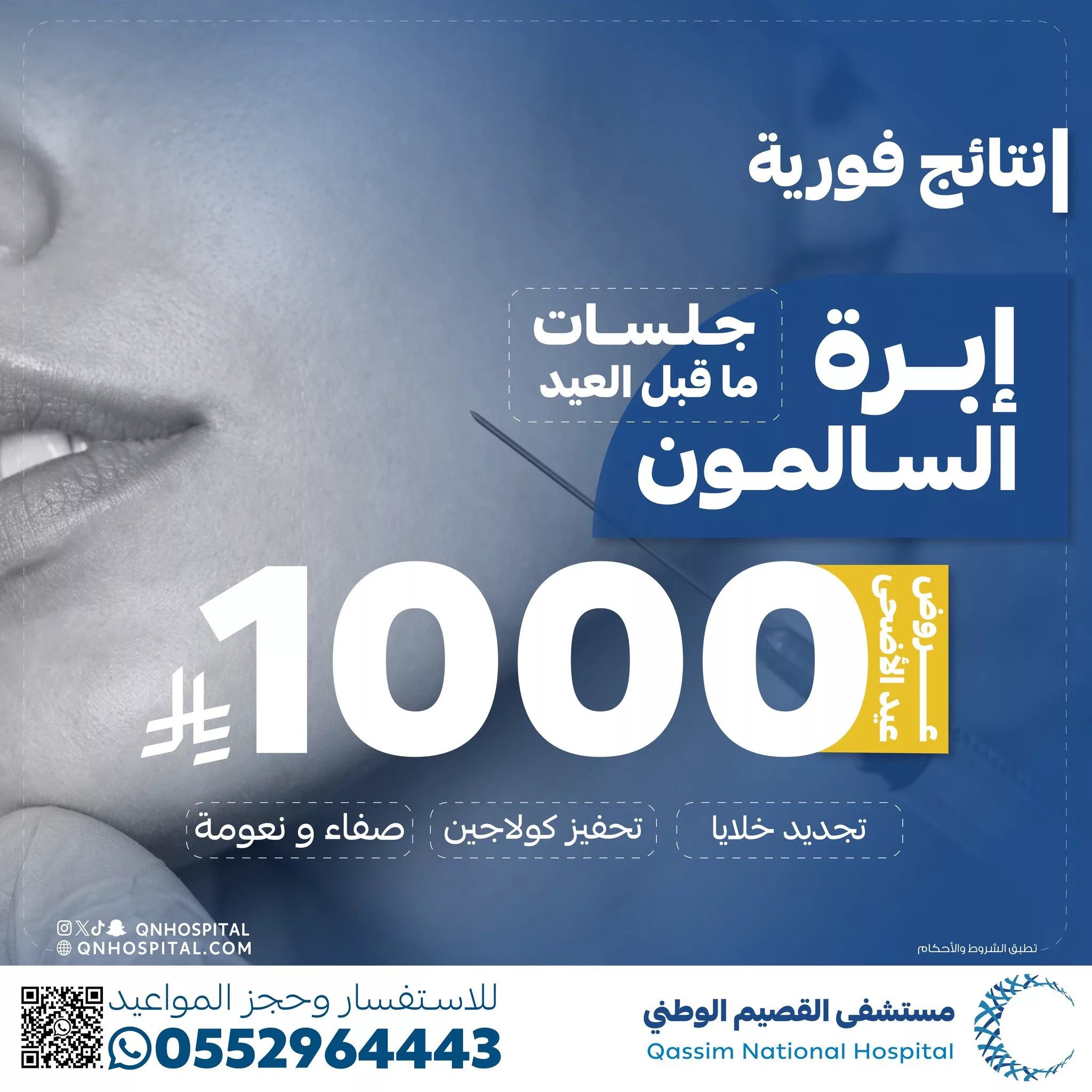 4 104 - عروض تجميلية مميزة بمستشفى القصيم الوطني بمناسبة عيد الأضحى